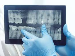 Preventive & Digital Dentistry in Vadodara — Ashirvad Dental Clinic